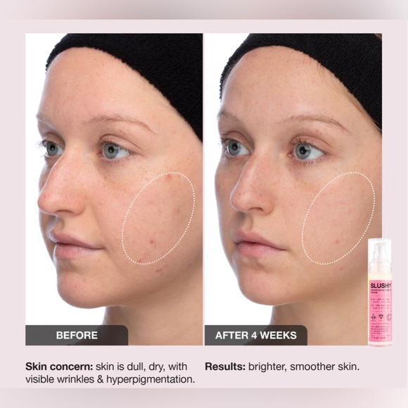 Slushy - INNBEAUTY Project
Serum Moisturizer 2N1
1.7 oz BRAND NEW - Picture 7 of 16